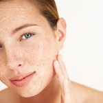 Tự chế kem trị mụn bọc hiệu quả dưới da cho da nhờn